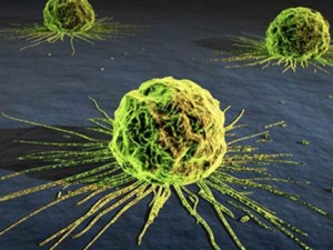  La enfermedad ataca por igual en hombres y mujeres.