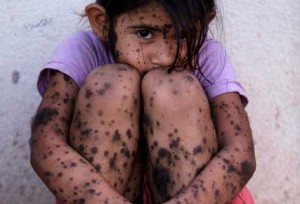 El martes vuelve a tratarse el proyecto de ley de agroquímicos en Entre Ríos.